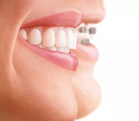 Dr. Marten Hensgens Fachzahnarzt für Kieferorthopädie Abbildung Nr. 14