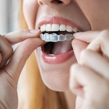 K10 Kieferorthopädie Dr. Judith Bäumler Abbildung Nr. 5