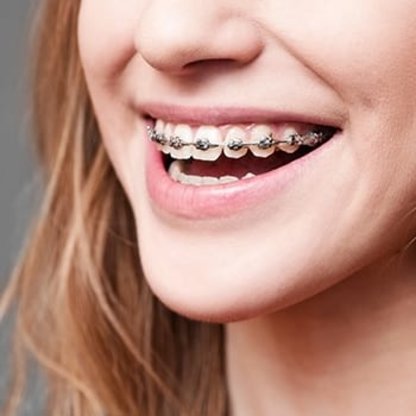 K10 Kieferorthopädie Dr. Judith Bäumler Abbildung Nr. 4