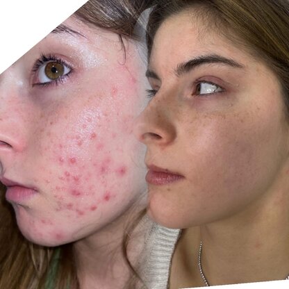 Beauty Zone Lübeck Abbildung Nr. 10