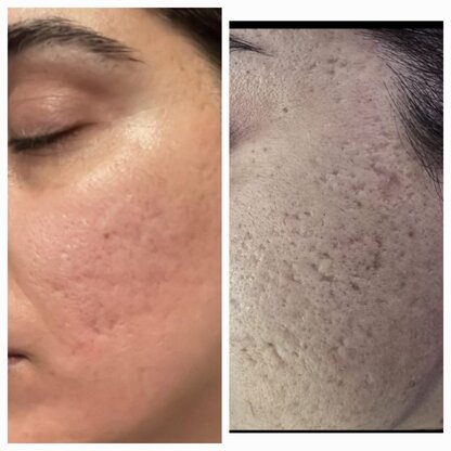 Beauty Zone Lübeck Abbildung Nr. 9