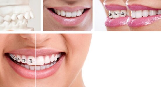 Kieferorthopädie Dr. Ines Graf Abbildung Nr. 12