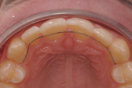 Kieferorthopädie Dr. Ines Graf Abbildung Nr. 5