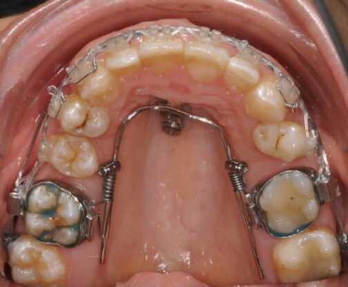 Kieferorthopädie Dr. Ines Graf Abbildung Nr. 4