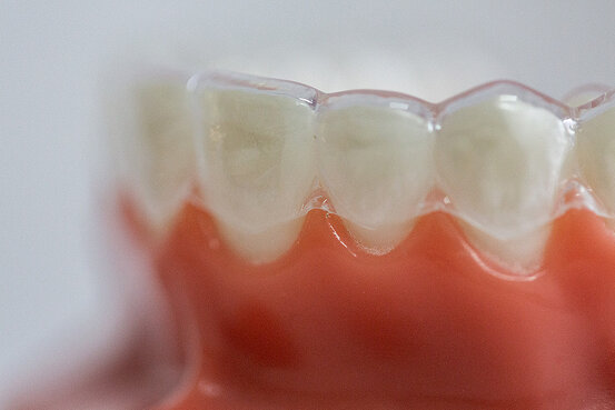 Kieferorthopädie - Praxis Dr. Claaßens Abbildung Nr. 5