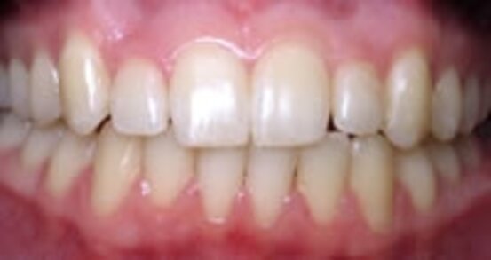 Kieferorthopädie - Dres. Czell Geretsried Abbildung Nr. 3