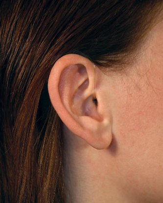 Peter Fitze Hörsysteme Abbildung Nr. 7