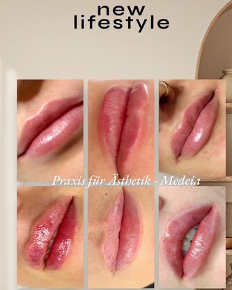 Praxis für Ästhetik - Medeia & TRUE MD SKIN CONCEPT Abbildung Nr. 5