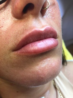 Lippen3
