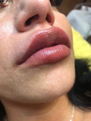 Lippen 2