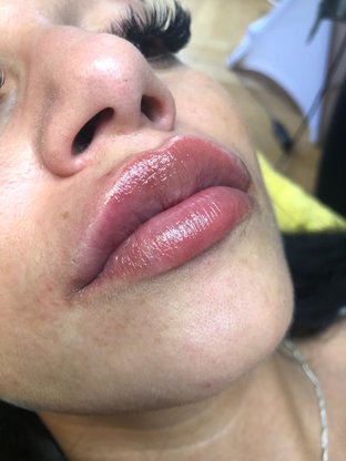 LIPPEN 1