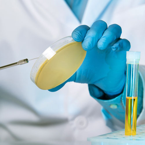 Viren gegen Bakterien: Was steckt hinter der Phagen-Therapie?