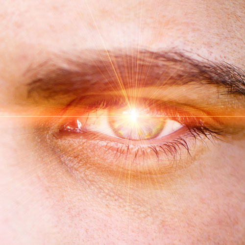 Scharfblick in Sekunden: Keine Angst vorm Augenlasern