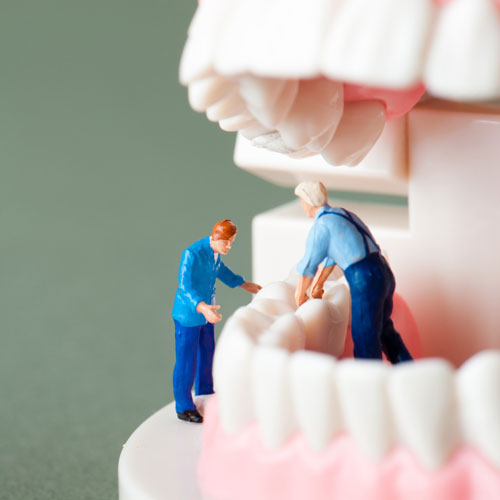 Weisheitszähne entfernen lassen: Wann ist eine OP wirklich notwendig?