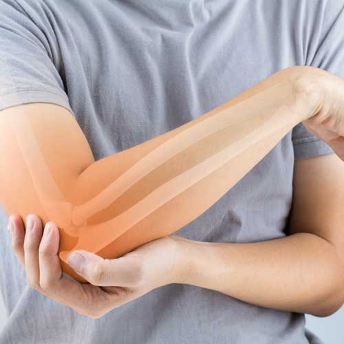 Diagnose Knochenschwund - Welche Therapien gibt es bei Osteoporose?